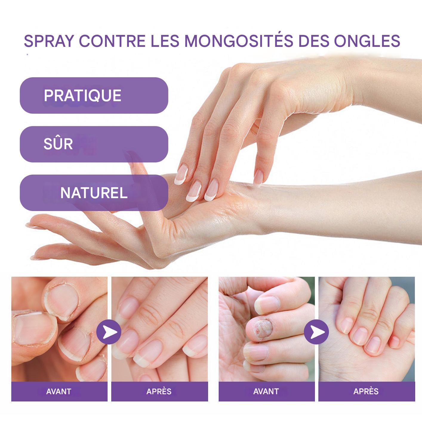 Spray Réparateur Ongles Naturel - Fortifiant & Anti-Mycoses 100 ml